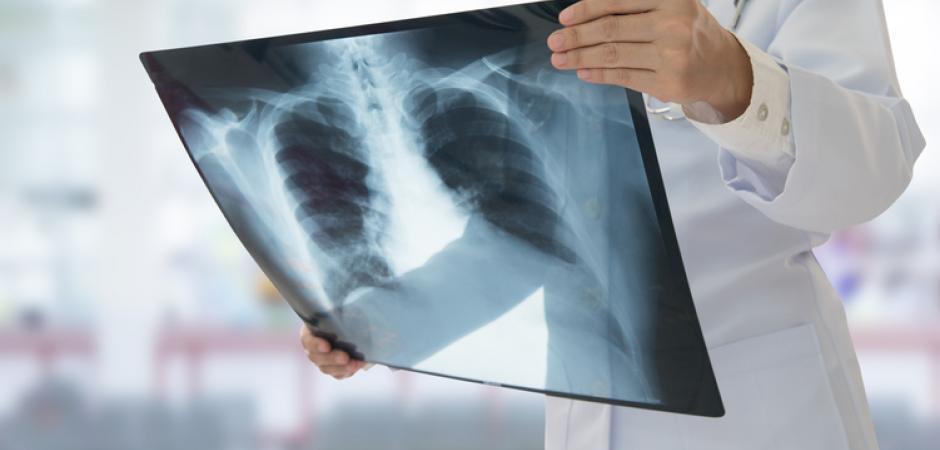 How to tell if you need an x-ray - Envision Radiology