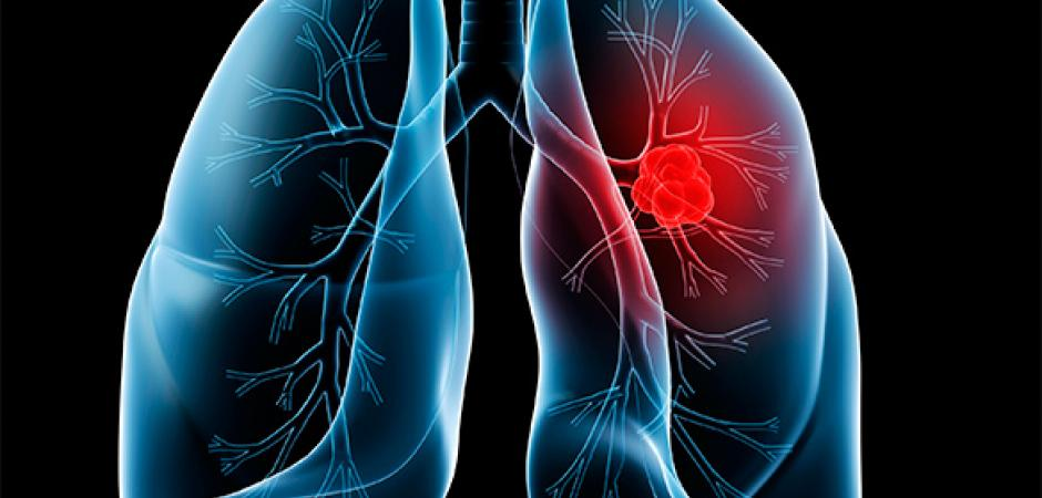 Cancer Care Cancer Care